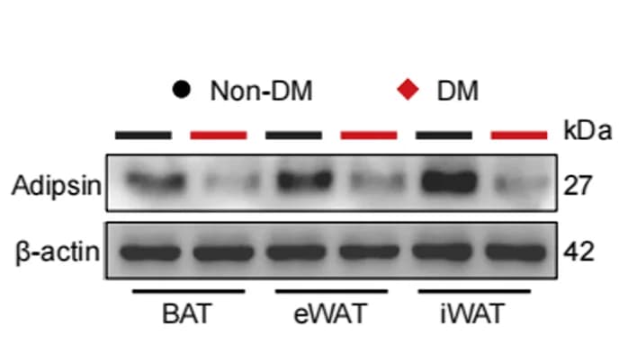 Open access visualization of Gel, Western Blot, Adipsin, Adipose Tissues, Brown Adipose Tissue