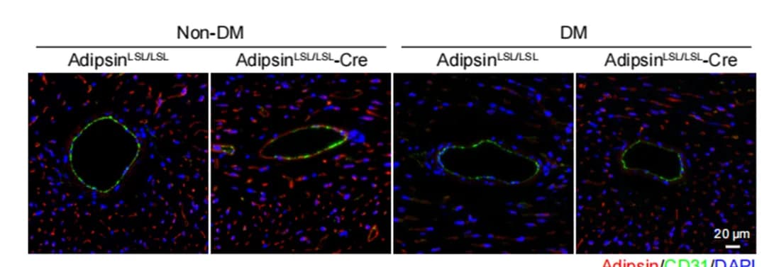 Open access visualization of Microscopy, Immunofluorescence, Adipsin, Blood vessels