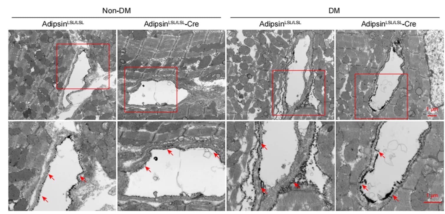 Open access visualization of Microscopy, Transmission electron micrographs, Cardiac capillaries, Lanthanum nitrate, Barrier function