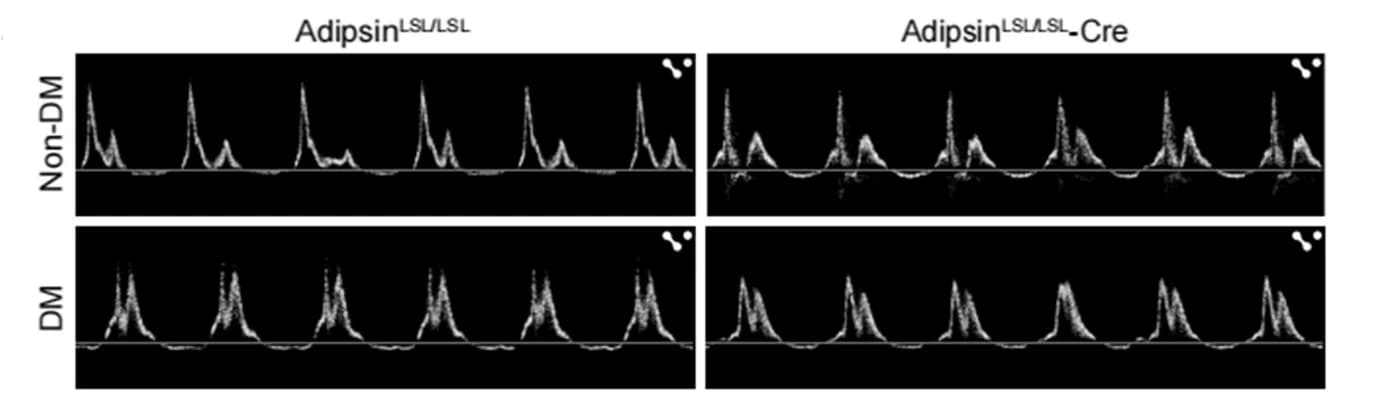Open access visualization of Line Plot, Echocardiography, Cardiac diastolic function
