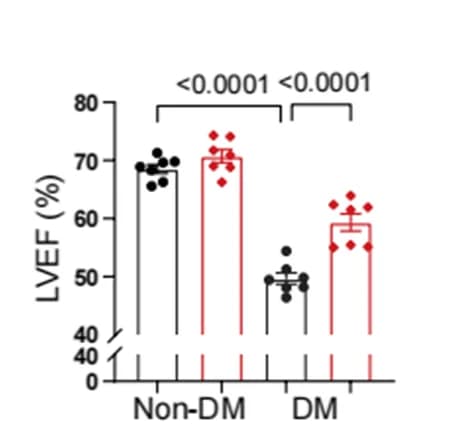 Open access visualization of Bar Plot, Error Bars, LVEF, Quantitative analysis, Left ventricular ejection fraction