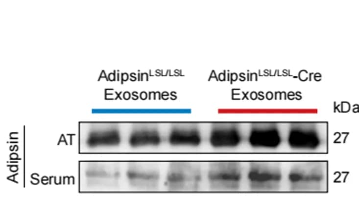 Open access visualization of Gel, Western Blot, Adipsin, Exosomes, Adipose Tissue