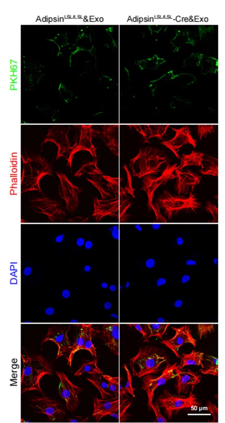 Open access visualization of Microscopy, Immunofluorescence, Exosomes, Cellular Uptake