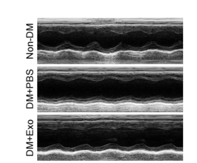Open access visualization of Microscopy, Echocardiography, Cardiac Systolic Function
