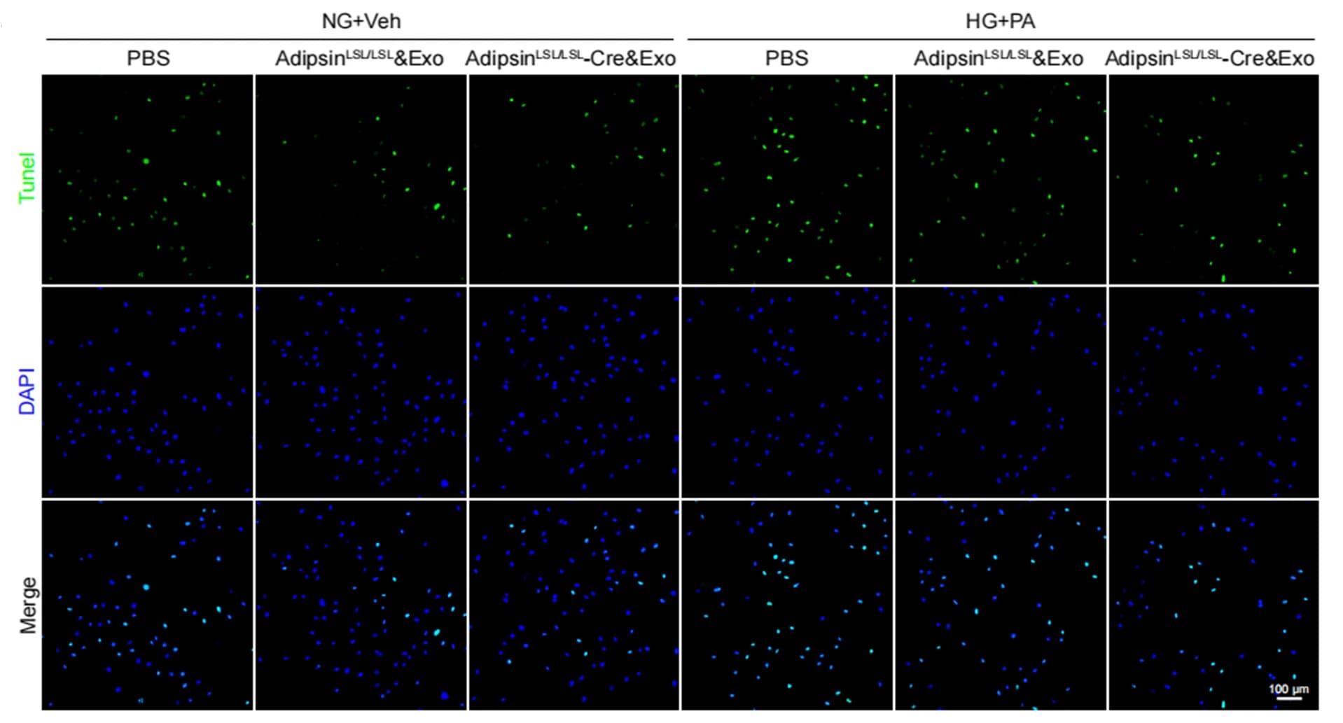 Open access visualization of Microscopy, TUNEL Assay, Apoptosis, CMECs