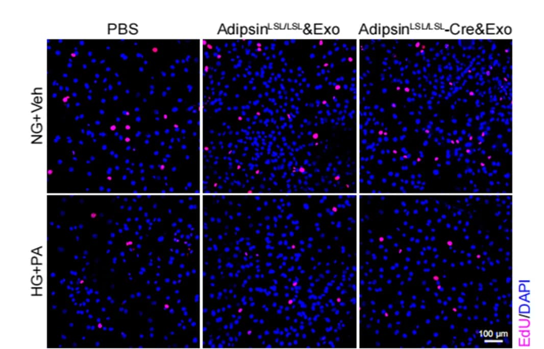 Open access visualization of Microscopy, Immunofluorescence, CMECs, EdU Assay, Proliferation