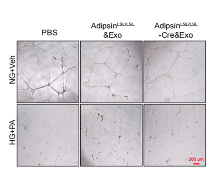 Open access visualization of Microscopy, Tube Formation, Angiogenesis