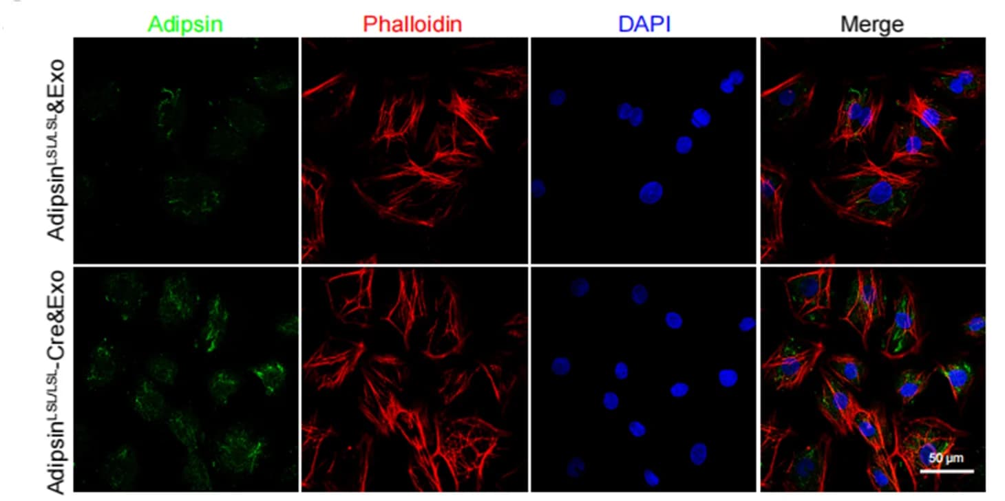 Open access visualization of Microscopy, Immunofluorescence staining, Adipsin, CMECs, Exosomes