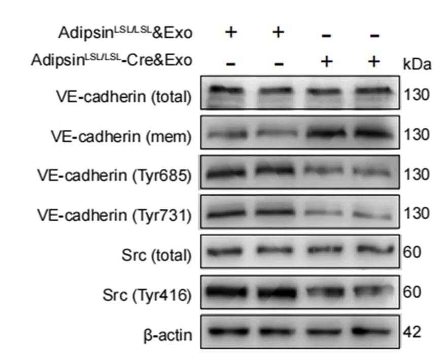 Open access visualization of Gel, Western blot, VE-cadherin, Phospho-VE-cadherin, Src