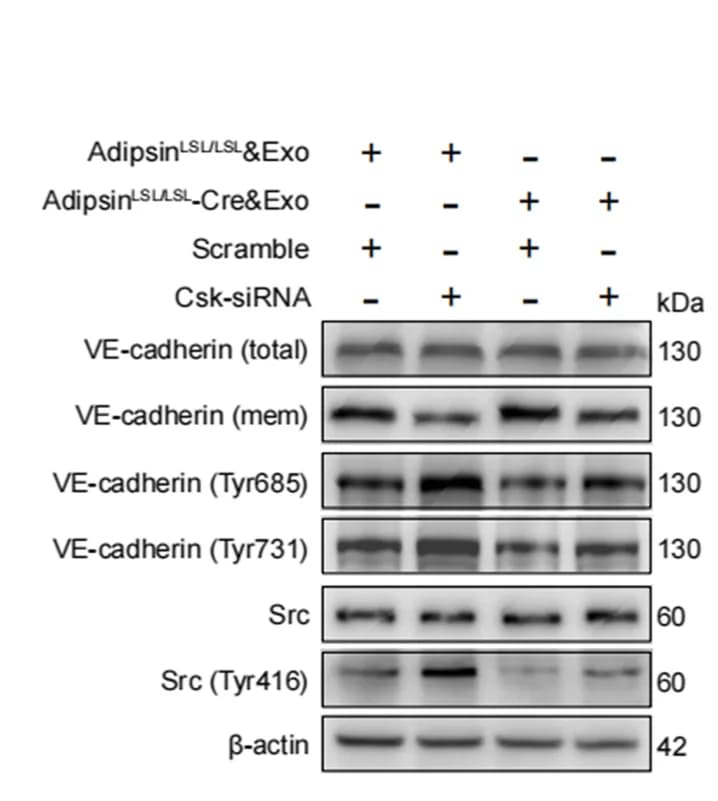 Open access visualization of Gel, Western Blot, VE-cadherin, Phospho-VE-cadherin, Src