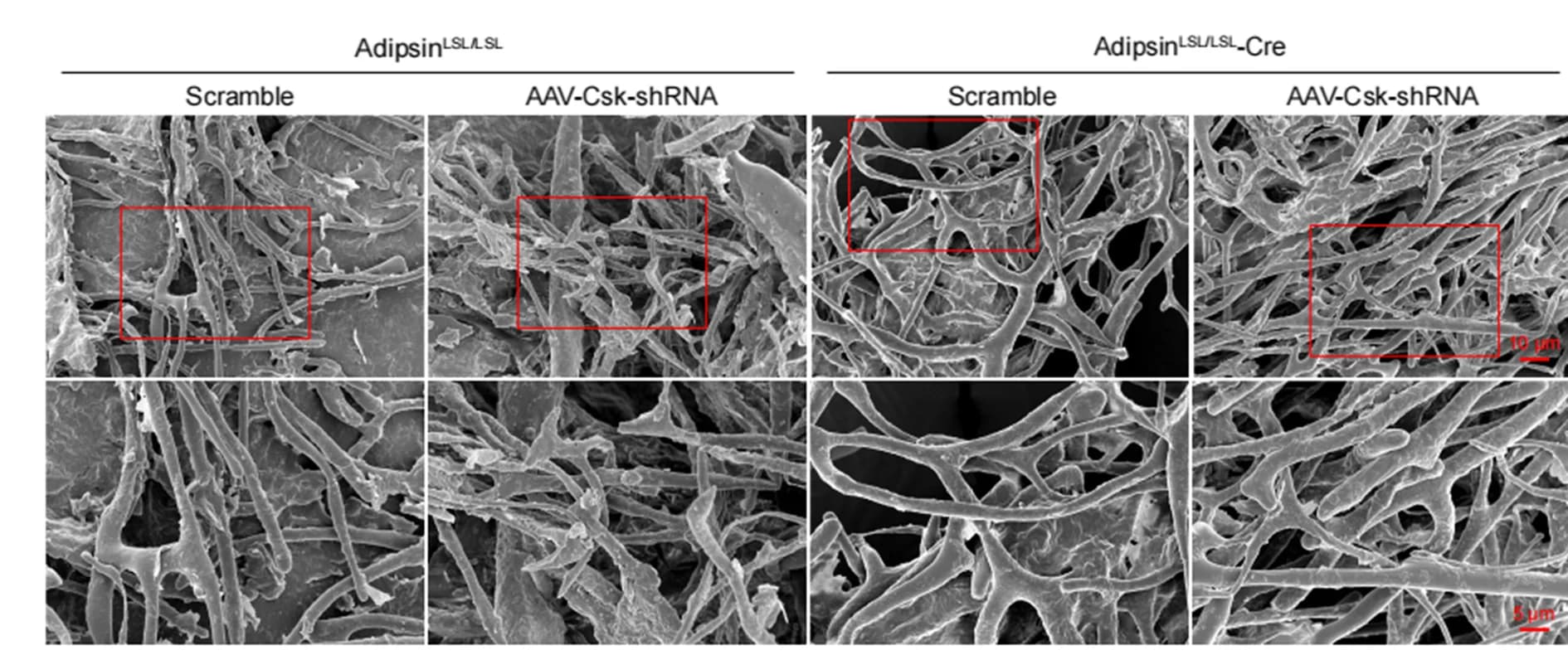 Open access visualization of Microscopy, Scanning Electron Microscopy, Cardiac Microvessels, Corrosion
