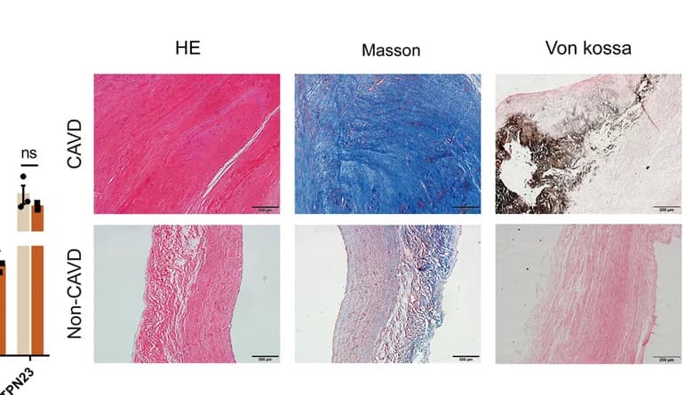 Open access visualization of Microscopy, Bar Plot, Error Bars, H&E Staining, Masson’s Trichrome Staining