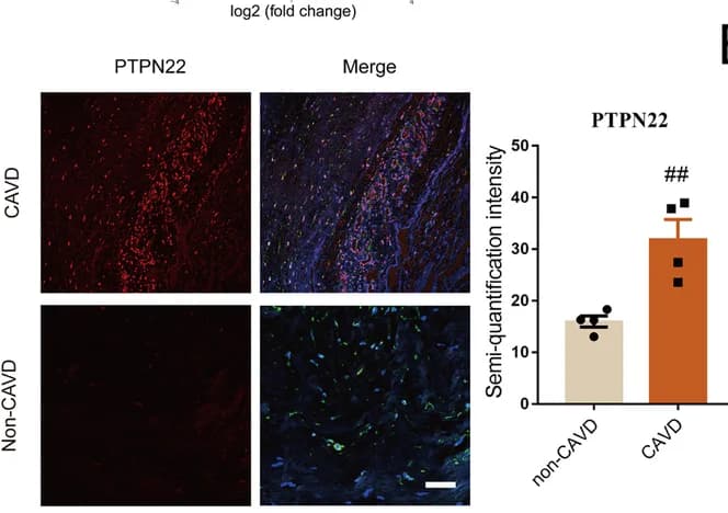 Open access visualization of Bar Plot, Error Bars, Microscopy, Immunofluorescent Staining, PTPN22