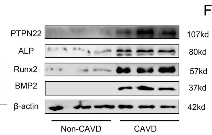 Open access visualization of Gel, Protein Expression, PTPN22, Tissue, Immunoblotting