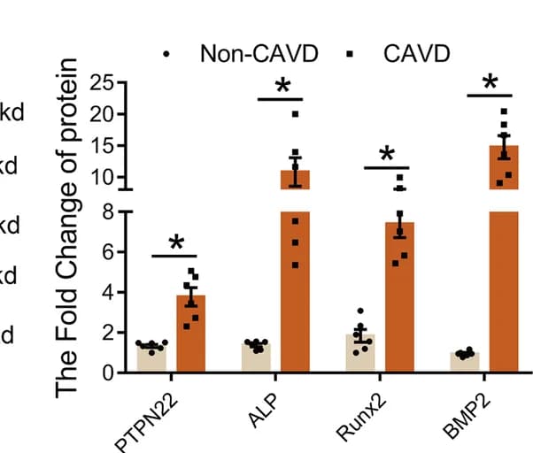 Open access visualization of Bar Plot, Error Bars, Clustered, Protein Expression, PTPN22