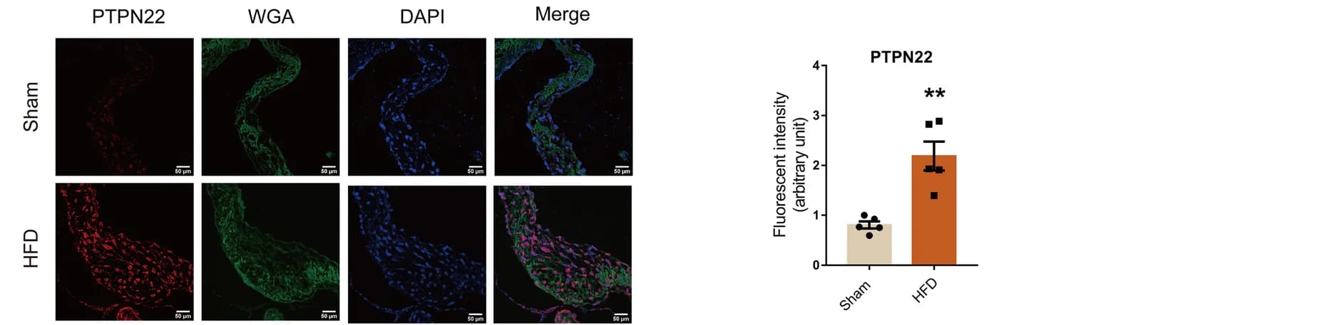 Open access visualization of Bar Plot, Error Bars, Microscopy, Photo, Immunofluorescent Staining