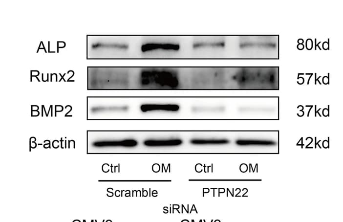 Open access visualization of Gel, Cells, PTPN22 siRNA, OM, Western blot