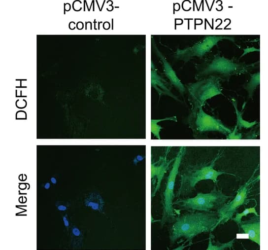 Open access visualization of Microscopy, DCFH-DA staining, AVICs, PTPN22