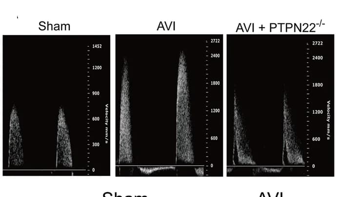 Open access visualization of Line Plot, Peak transvalvular jet velocity