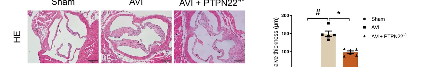 Open access visualization of Bar Plot, Error Bars, Microscopy, Photo, Aortic Valves