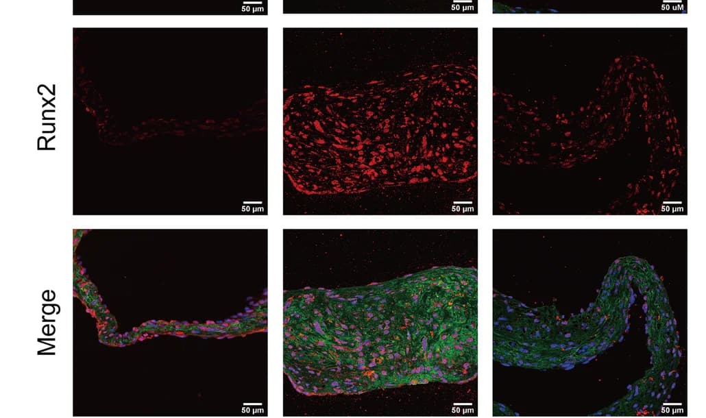 Open access visualization of Microscopy, Immunofluorescence, Aortic Valve, DAPI, WGA