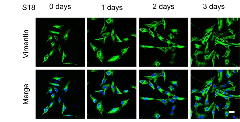 Open access visualization of Microscopy, Cell Morphology, Human AVICs, S18