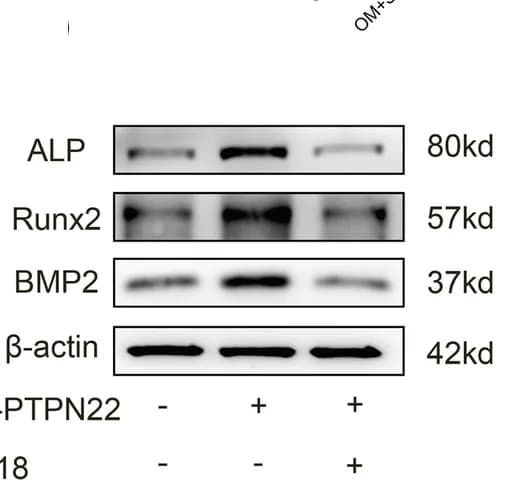 Open access visualization of Gel, Human AVICs, Transfection, pCMV3-PTPN22, pCMV3-Control