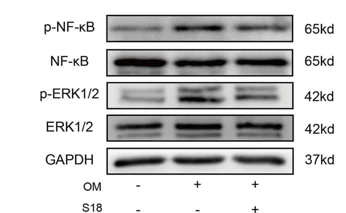 Open access visualization of Gel, Western Blot Analysis, NF-κB Phosphorylation, ERK1/2 Phosphorylation