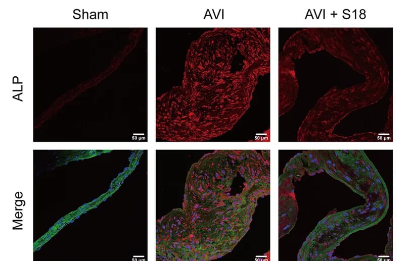 Open access visualization of Microscopy, Photo, Immunofluorescence, Aortic Valve, DAPI