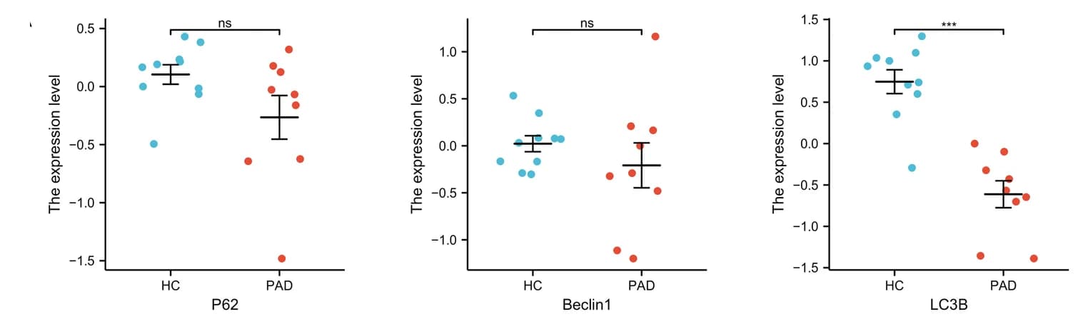 Open access visualization of Scatter Plot, Error Bars, mRNA, Autophagy, p62