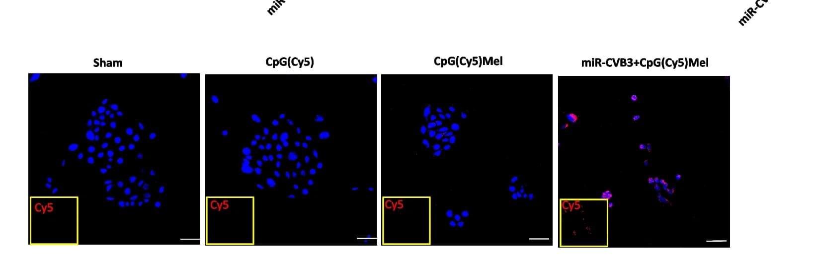 Open access visualization of Microscopy, CpG(Cy5) Internalization, 4T1 Cells, CpG(Cy5)Mel, miR-CVB3