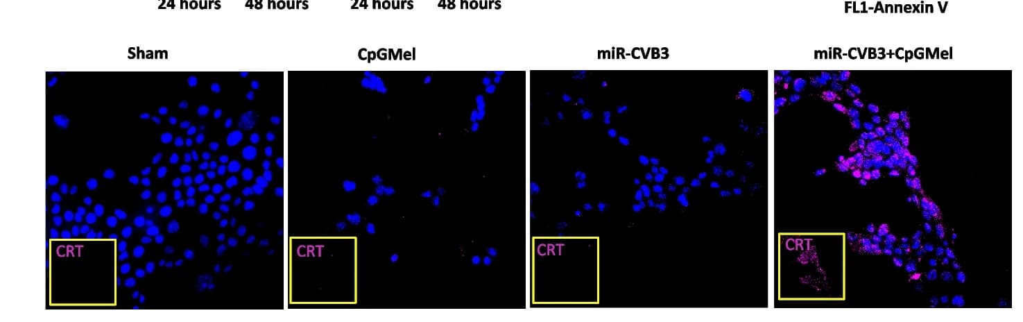 Open access visualization of Microscopy, 4T1 Cells, Immunostaining, Calreticulin, CRT