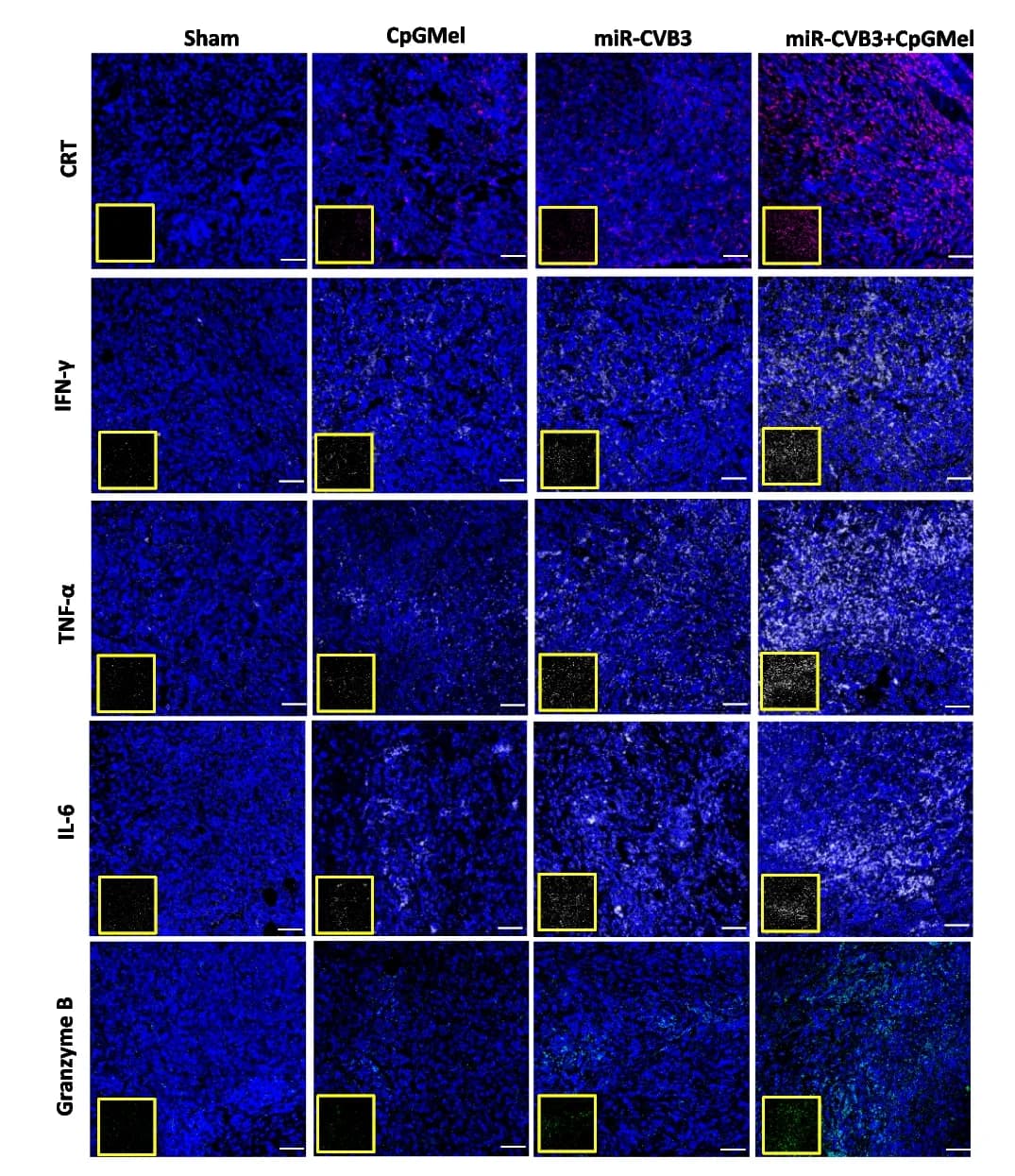 Open access visualization of Microscopy, CRT, IFN-γ, TNF-α, IL-6