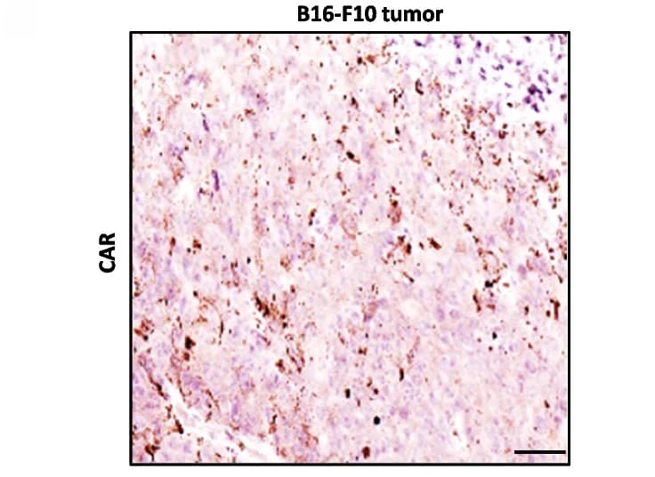 Open access visualization of Microscopy, IHC staining, CAR, B16F10 Tumor