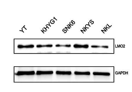 Open access visualization of Gel, Western Blotting, LMO2, Natural Killer/T-Cell Lymphoma, Cell Lines