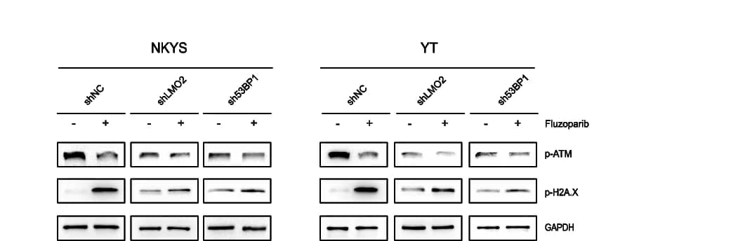 Open access visualization of Gel, Western Blotting, p-ATM, p-H2A.X, shNC