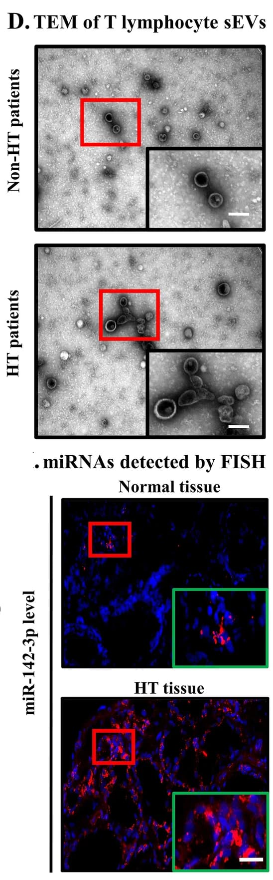 Open access visualization of Microscopy, FISH, miR-142-3p, Thyroid Glands, Healthy Controls
