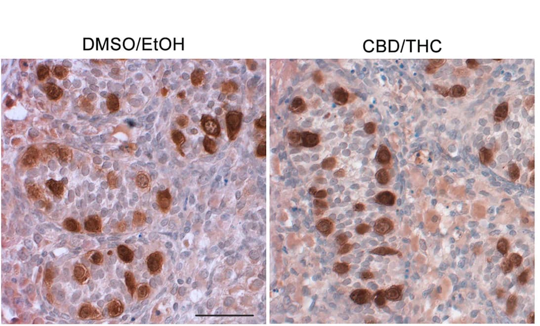 Open access visualization of Microscopy, Immunostaining, LIN28, Germ Cell, CBD