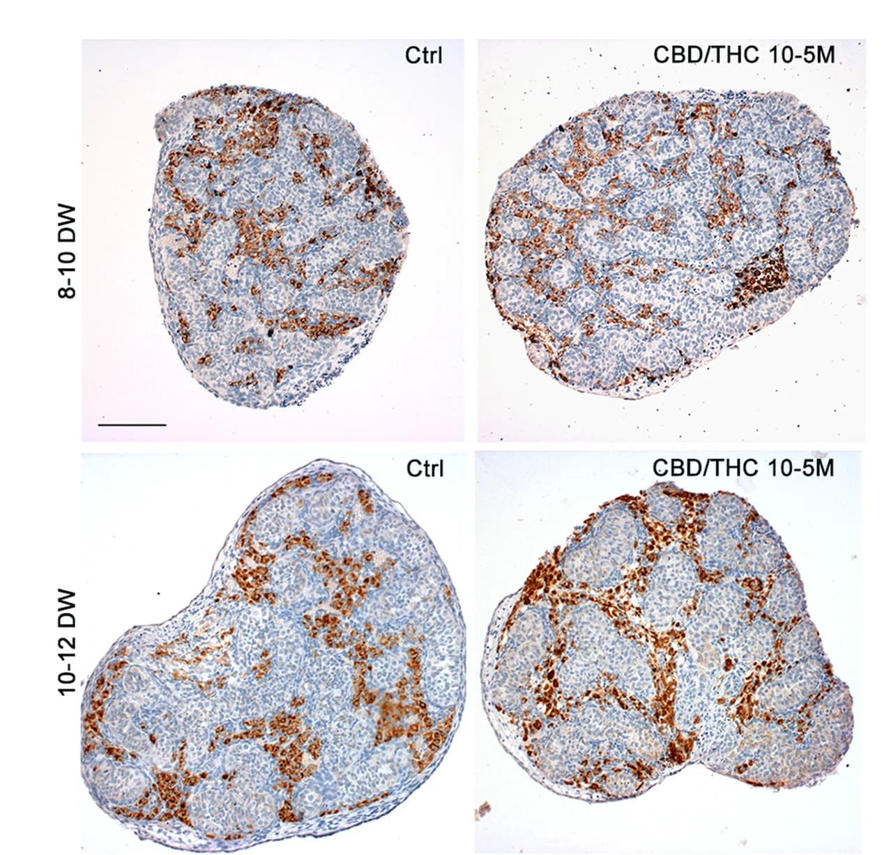 Open access visualization of Microscopy, Immunostaining, CYP11A1, Fetal Human Testis, CBD