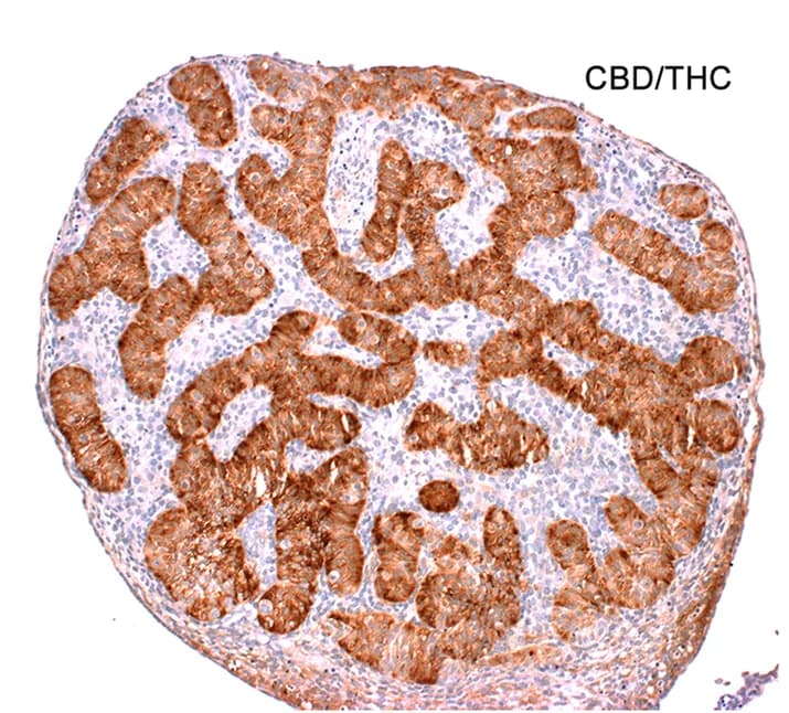 Open access visualization of Microscopy, Immunostaining, AMH, Sertoli Cell, Fetal Testis