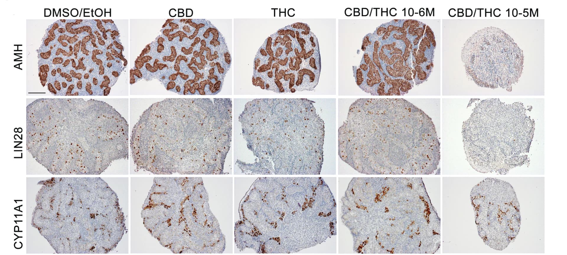 Open access visualization of Microscopy, Immunostaining, Testis, AMH, LIN28A