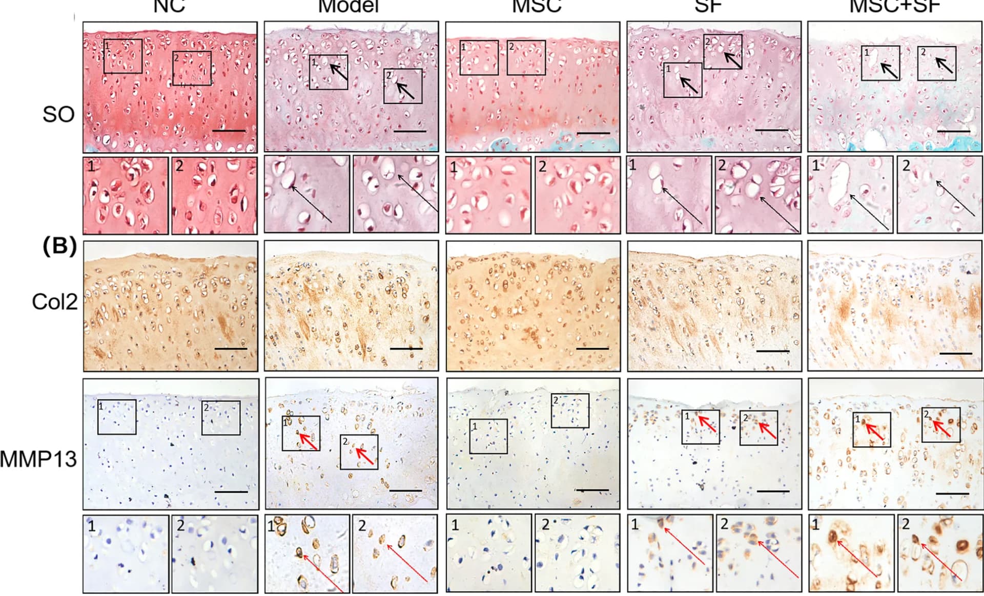 Open access visualization of Microscopy, Safranin O/Fast Green Staining, Cartilage, Chondrocytes, Histopathology