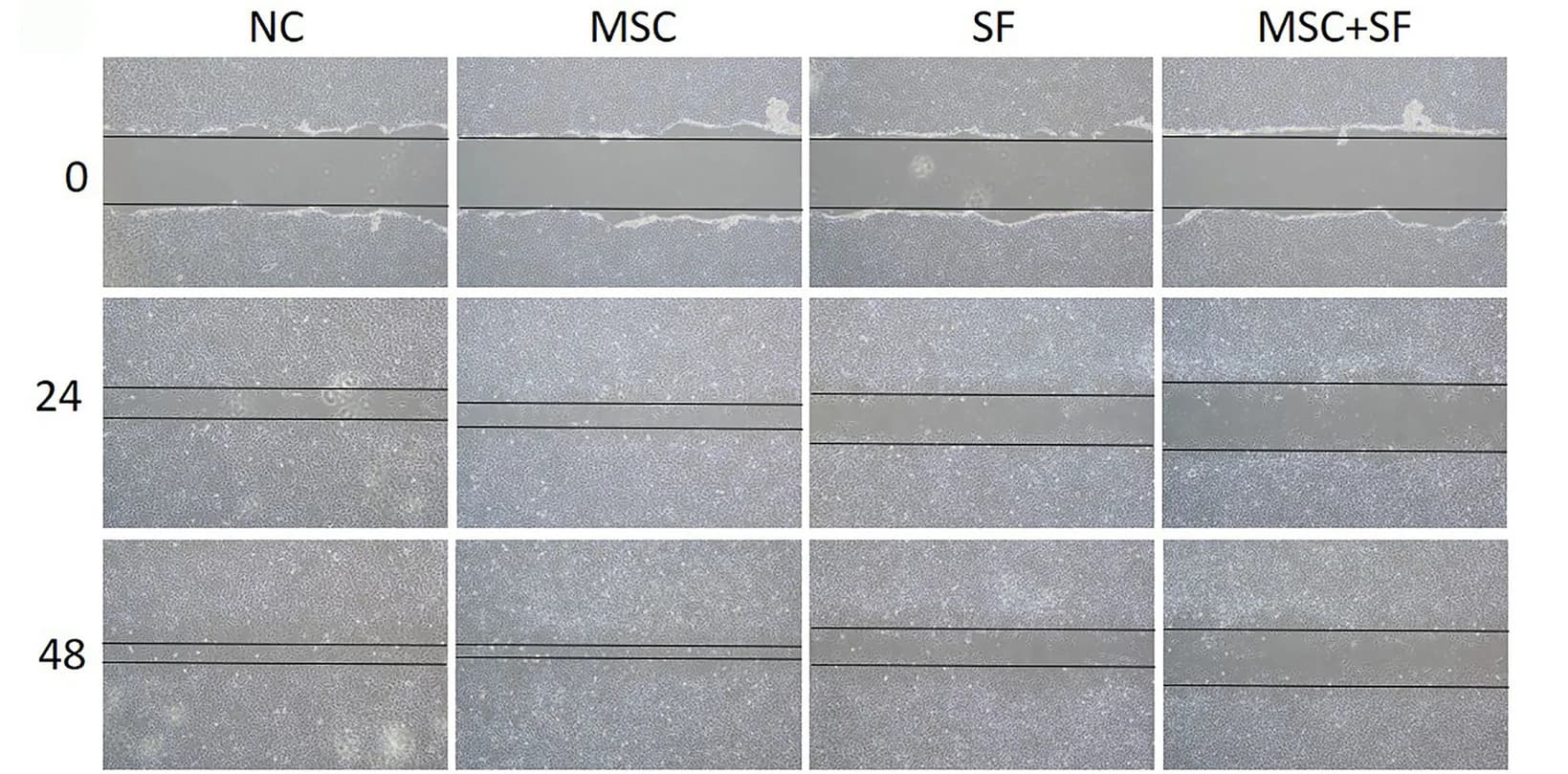 Open access visualization of Microscopy, Wound Healing, Chondrocytes, hucMSCs, SF Treatment