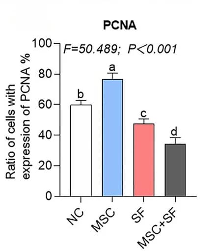 Open access visualization of Bar Plot, Error Bars, PCNA, Cell Ratio, Quantification