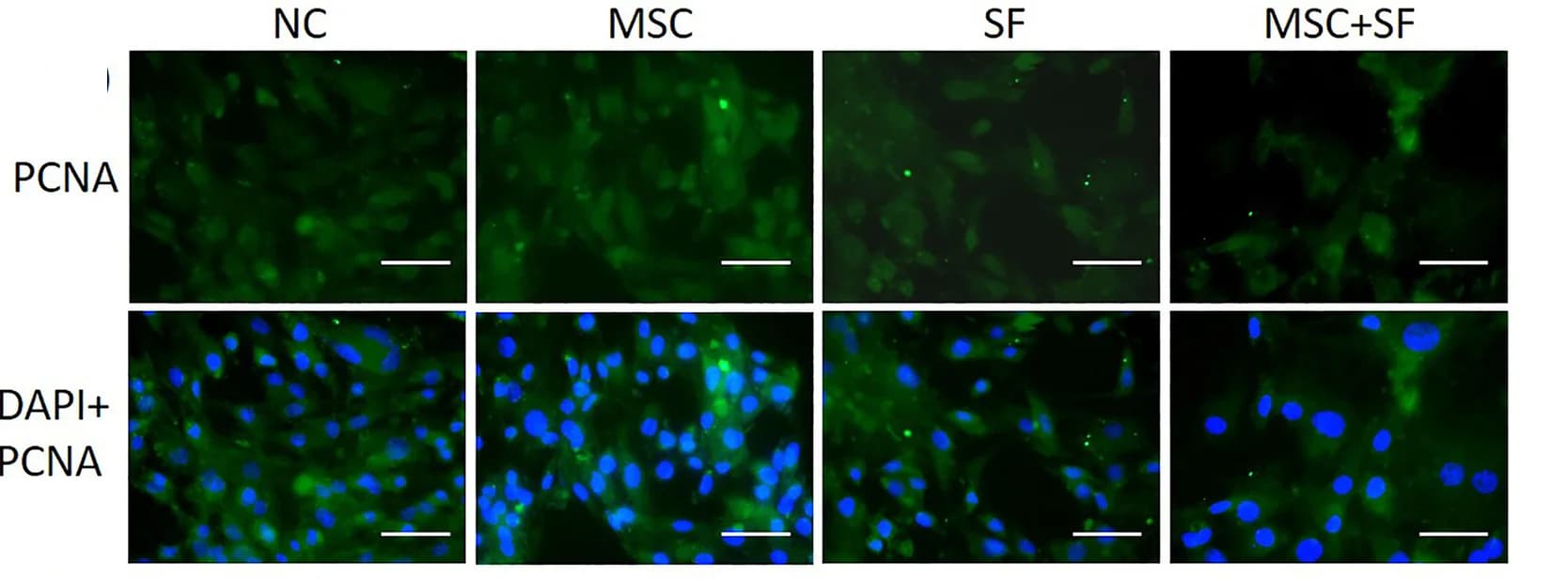 Open access visualization of Microscopy, Cell Immunofluorescence, Chondrocytes, hucMSCs, SF Treatment