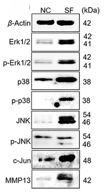 Open access visualization of Gel, Protein bands, hucMSCs, SF