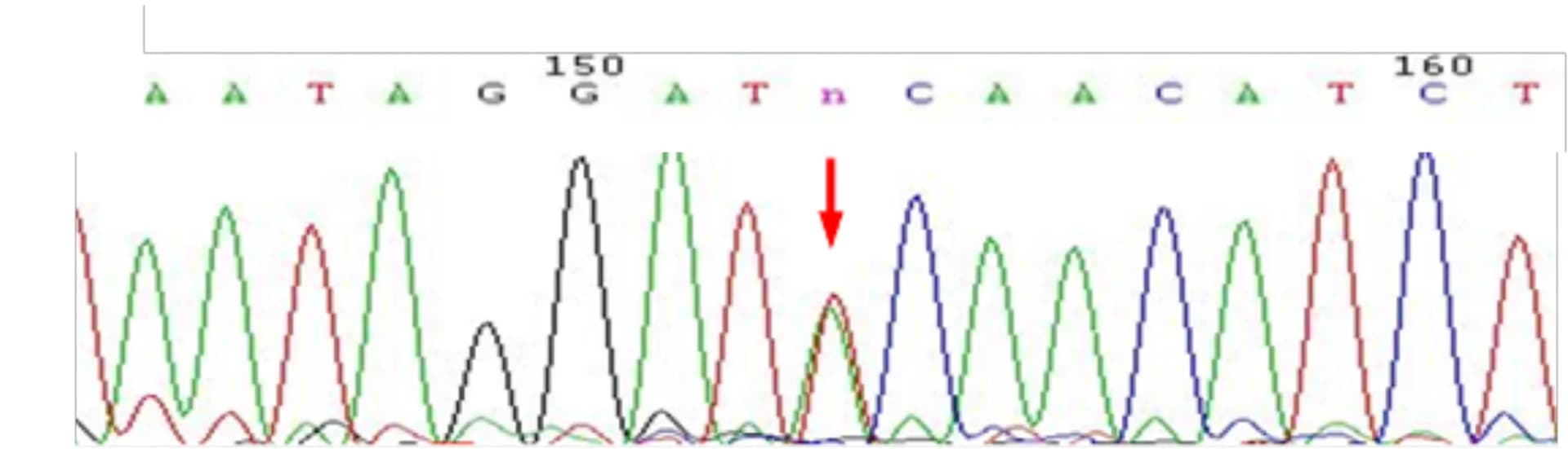 Open access visualization of Line Plot, Sequencing Chromatogram, ZDHHC21 Mutation, Patient