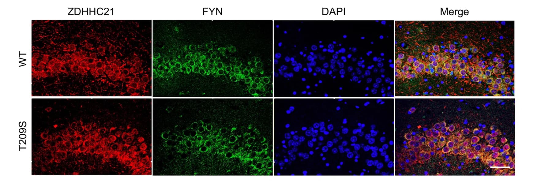 Open access visualization of Microscopy, Immunofluorescence, ZDHHC21, FYN, DAPI