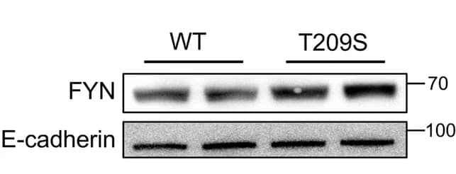 Open access visualization of Gel, Immunoblot, Quantification, FYN, Membrane Proteins