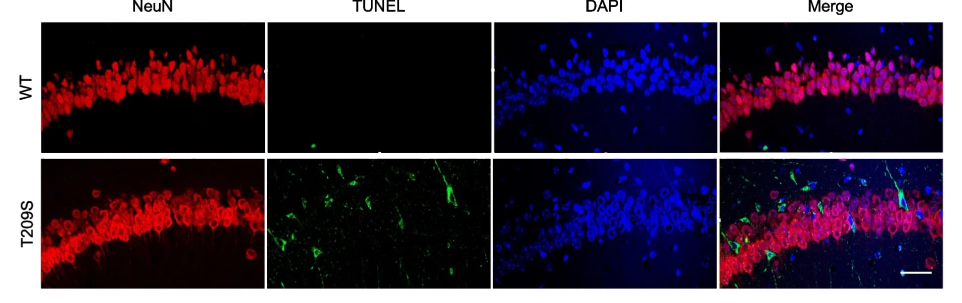 Open access visualization of Microscopy, Immunofluorescence, TUNEL-reactive cells, CA1 regions, Hippocampi